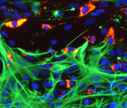 Microglia in a spinal cord slice transecting injury site showing avid loading and competitive uptake of nanoparticles (red) versus slice astrocytes (green). Nuclei in blue, photo Alan Weightman
